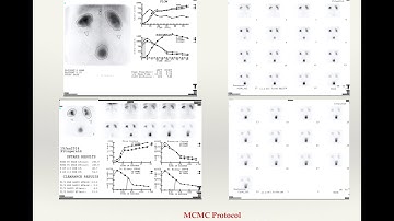 Renal Scintigraphy