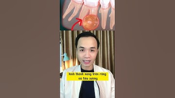 Mài răng có thể bị chết tuỷ #nhakhoa #vnteeth