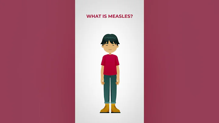 What's the deal with measles?