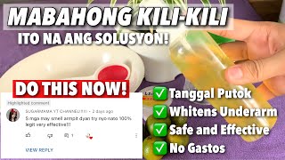 Download Lagu PUTOK AT MABAHONG KILIKILI | PAANO MAWALA ANG AMOY NG KILIKILI | PAANO MAWALA ANG PUTOK SA KILIKILI MP3 Download Lagu PUTOK AT MABAHONG KILIKILI | PAANO MAWALA ANG AMOY NG KILIKILI | PAANO MAWALA ANG PUTOK SA KILIKILI MP3