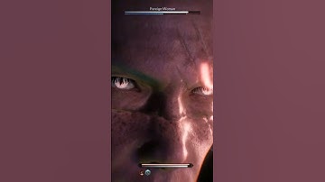 Lock In Ronin | Rise Of The Ronin #gamingshorts #riseoftheronin #shorts