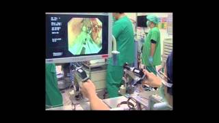 Robot-Assisted Endoscopic Submucosal Dissection Is Effective in Treating Patients...
