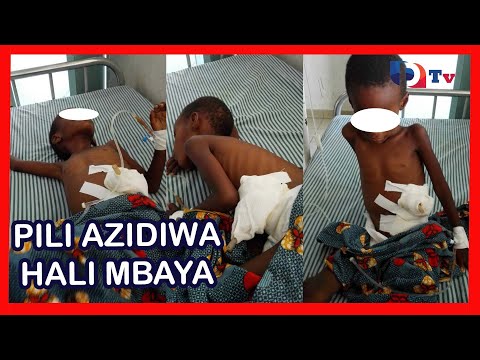HALI YA PILI YAZIDI KUA MBAYA ANAKULA NA MIPILA