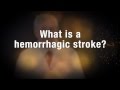 Medical Moment: Hemorrhagic Stroke