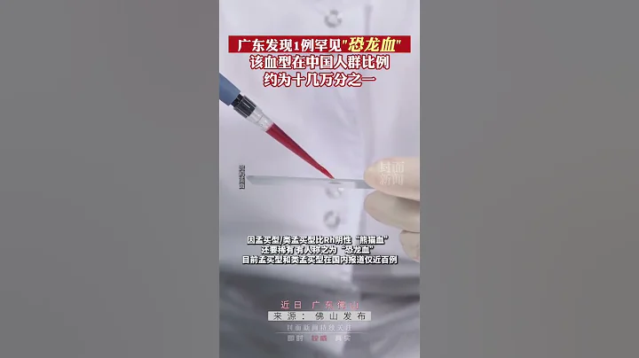 廣東佛山發現1例罕見“恐龍血”，該血型在中國人群比例約為十幾萬分之一 - 天天要聞