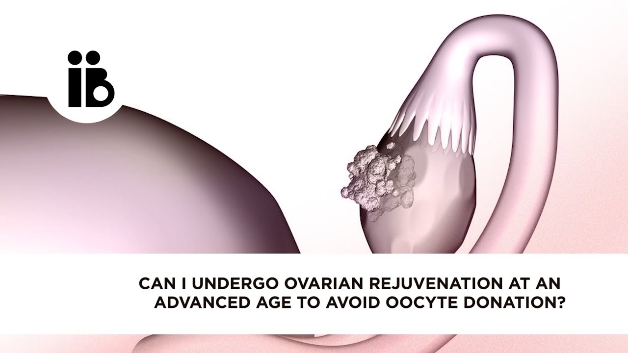 Ovarian Rejuvenation