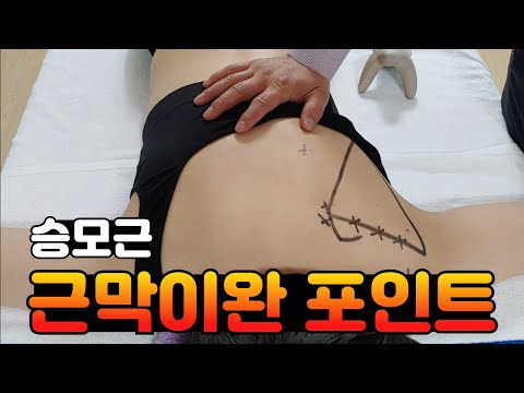 승모근 중부, 하부섬유 근막이완 포인트 - 트리거포인트와 발통점 촉진 및 허혈성 압박 테크닉(feat.알찬손, 힘찬손) : 강성규 근육연구소 오프라인 강의