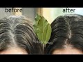 Gray hair turns into black hair permanently in 4 minutes 100 effective