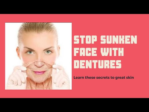 Sunken Face With Dentures Real Demo Video And How To Stop Facial Sinking