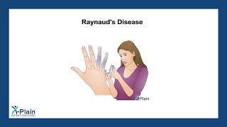 Raynaud's Disease