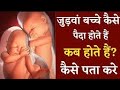 “जुड़वा बच्चे कैसे बनते हैं? जन्म के समय और कारण | Science Explained”
