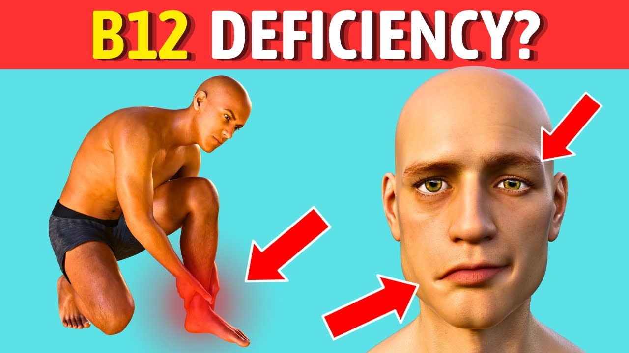 These Are The WARNING SIGNS Of B12 Deficiency In Your Body How To these-are-the-warning-signs-of-b12-deficiency-in-your-body-how-to