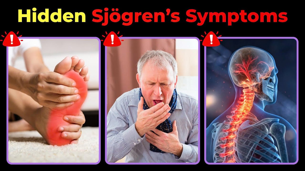 Senior? Hidden Primary and Secondary Sjögren’s Symptoms You Must Know Now!