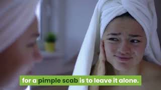 How to Get Rid of Pimple Scabs: Causes and Treatments | Remove Pimples Scabs