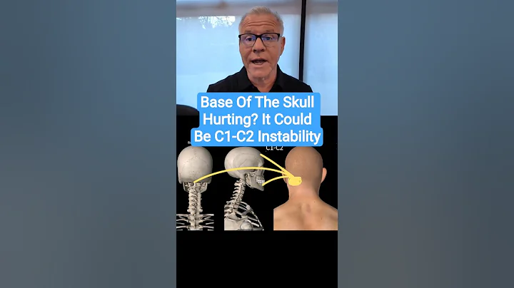 Do You Have Headaches at the Base of the Skull? What Does that Mean?