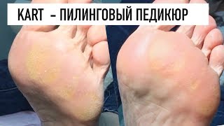 Карт педикюр ( KART pro feet. Израиль) + аппаратный Карт педикюр ( KART pro feet. Израиль) + аппаратный