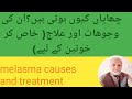 melasma causes and treatment | melasma treatment at home | javedan pharmacy.