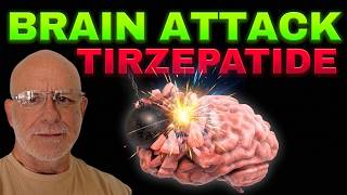 Tirzepatide & The Brain: Stopping a 'Brain Attack' Before It Starts