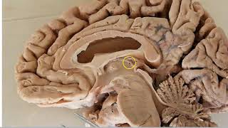 Diencephalon Anatomy