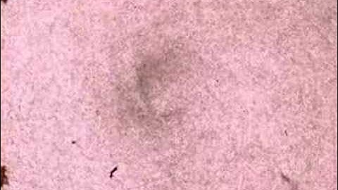 Electrohydrodynamically-driven blood plasma separation