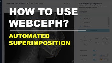 How to use WEBCEPH: Automated Superimposition
