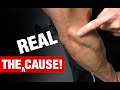The Truth About Tennis Elbow (WHAT REALLY CAUSES IT!)
