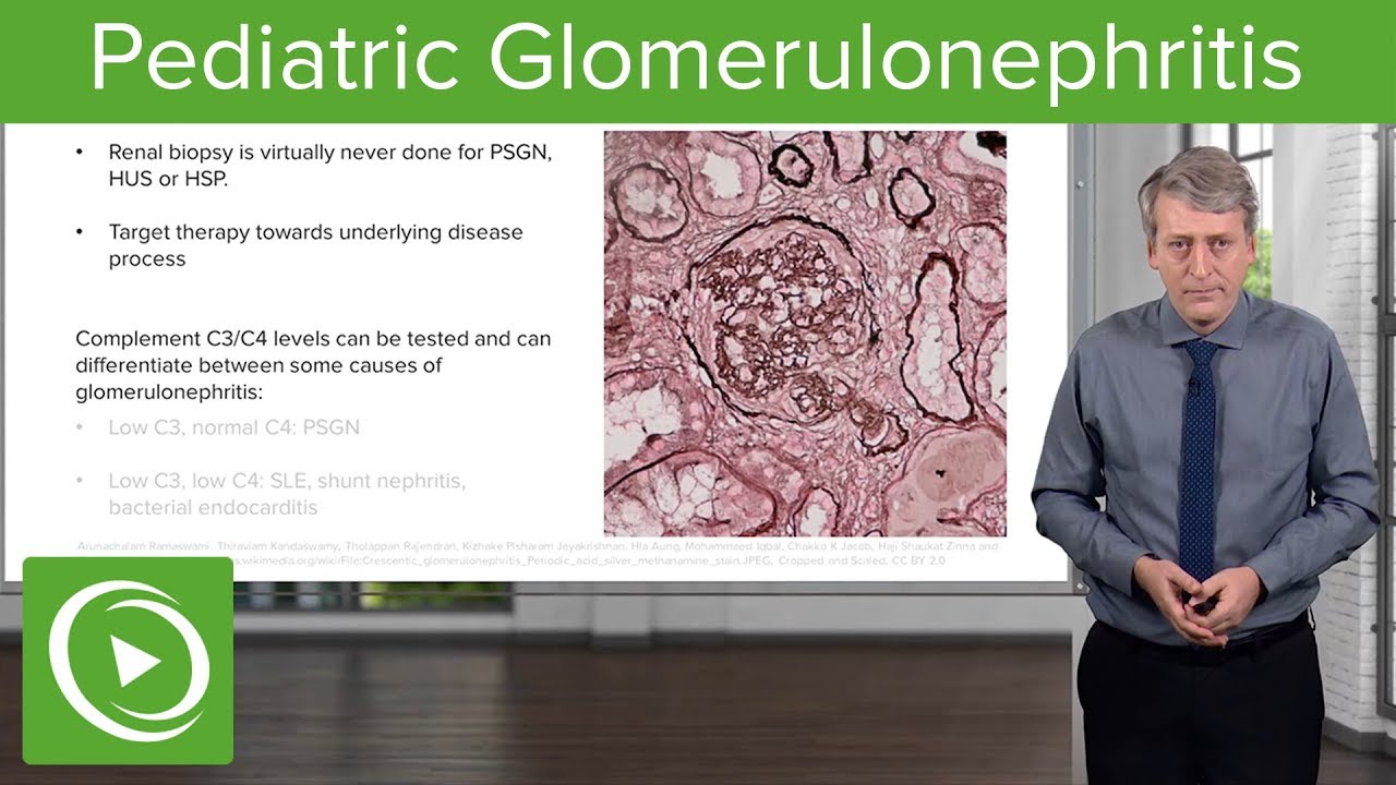 Pediatric Glomerulonephritis – Pediatrics | Lecturio