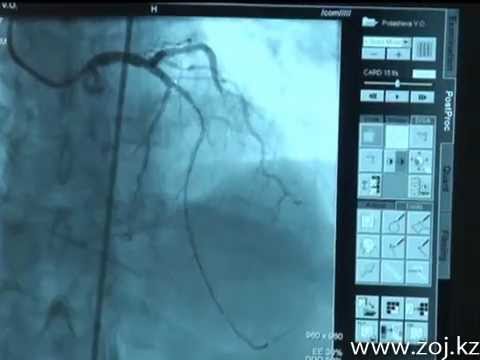 Video: Anatómia, Funkcia A Diagram Dolných Frenických Tepien Karosárske Mapy