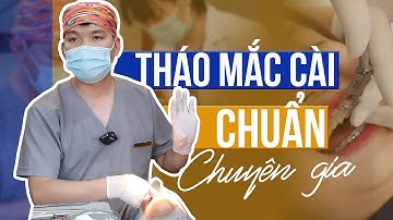 Hướng Dẫn Tháo Mắc Cài Niềng Răng Chuẩn Chuyên Gia | Bác sĩ Trung Long Biên