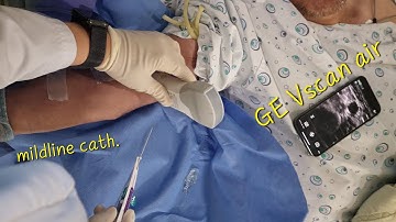 Midline catheter insertion with GE Vscan air
