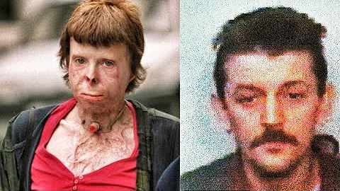Woman Dies 22 Yrs After Being Set On Fire Yet Her ...