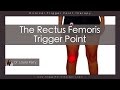 The Rectus Femoris Trigger Point