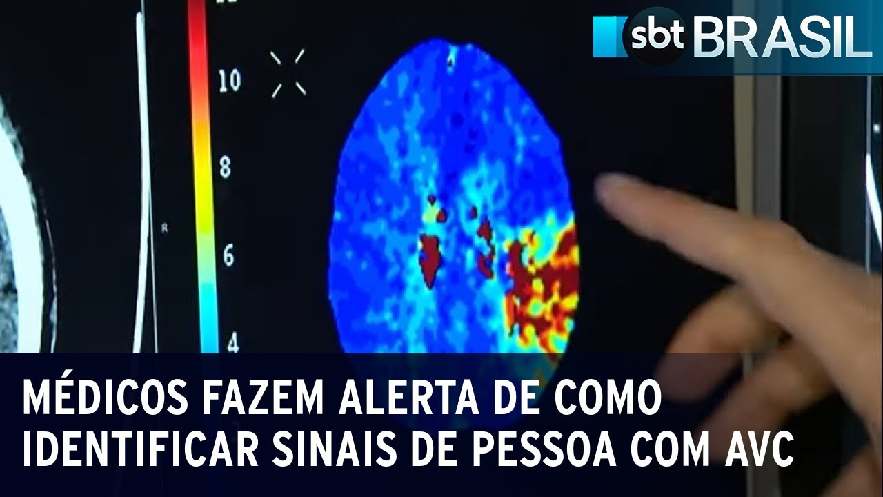 Médicos fazem alerta de como identificar sinais de pessoa com AVC | SBT Brasil (10/12/22)