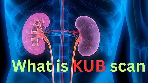 Kidney Urethral bladder scan/ kub scan