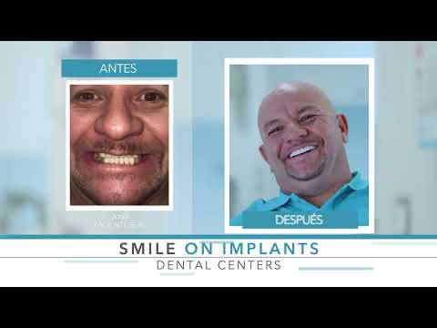 Bienvenido a SmileOnImplants Dental Centers!