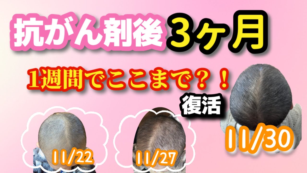 【乳がんステージ3】抗がん剤終了後3ヶ月✨ 約1週間でここまで復活！ ♯乳がん #がんサバイバー＃脱毛