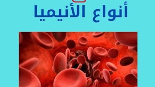 أنواع الأنيميا فقر الدم _ classification of anemia