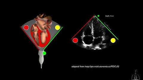 02  Knobology, Image Optimization and Transducer Manipulation.