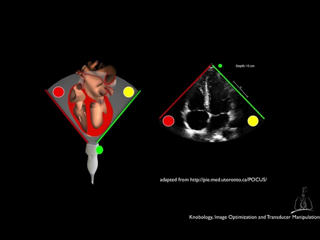 02  Knobology, Image Optimization and Transducer Manipulation.