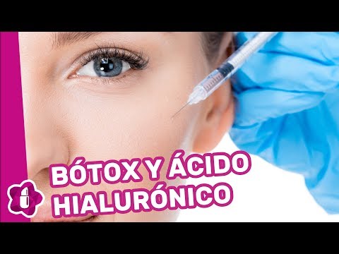 Bótox y ácido hialurónico, ¿cuándo aparecen los resultados?