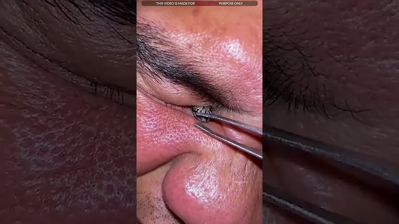 Latest Title & Thumbnail