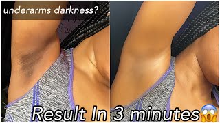 how to get rid of dark underarms permanently in 3 minutes (instant result)underarms darkness removal