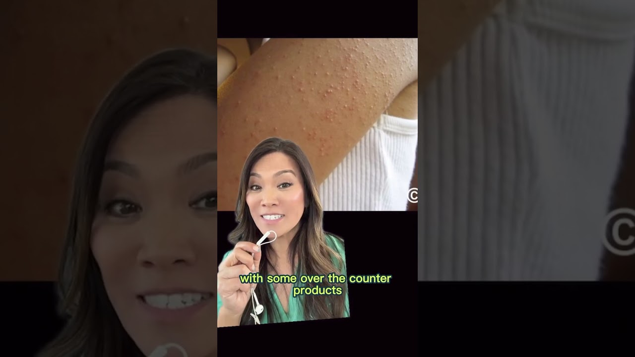 If you have stubborn bumps on your arms or legs 🍓