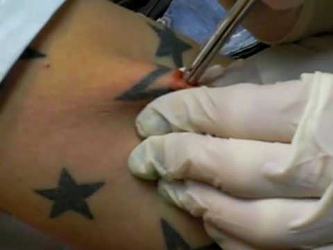 selbstbefriedigung wie dermal anchor blutet selbstbefriedigung wie dermal anchor blutet