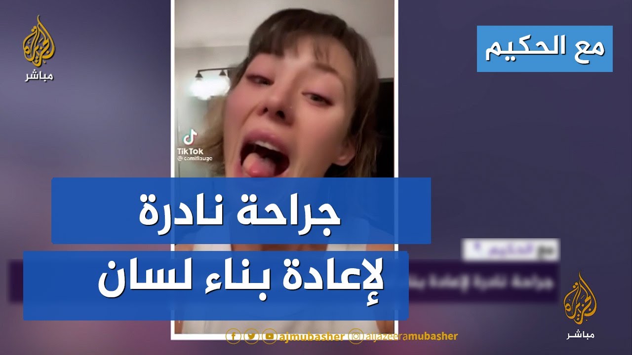 مع الحكيم.. جراحة نادرة لإعادة بناء لسان سيدة أمريكية بعد إصابته بالسرطان