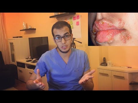 أمراض جلديه شائعه تظهر حول الفهم وعلاجها