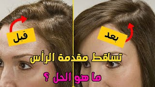 وداعا لمشكلة تساقط الشعر