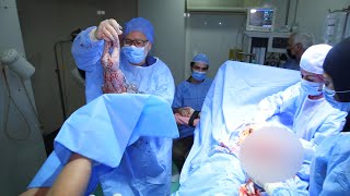 ولادة 3 توائم من عملية حقن مجهري علي يد الدكتور محمد مقبل