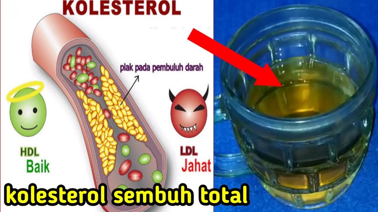 15 Cara Menurunkan Kolesterol Tinggi Secara Alami Dengan