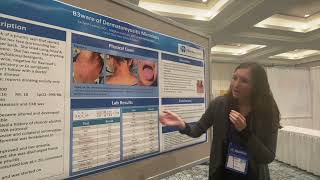 Beware of Dermatomyositis Mimickers: Dr. Jaclynn Levine at RWCS 2022